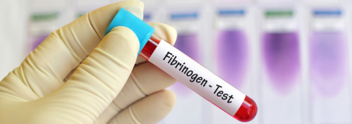 בדיקת פיברינגן (Fibrinogen) - תמונה